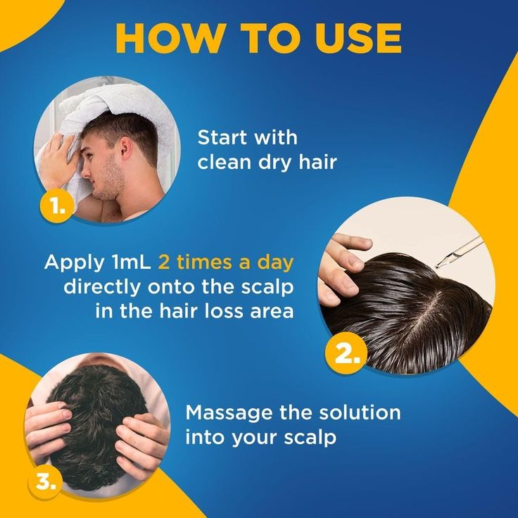 minoxidil hair growth